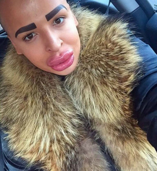 Illustration for article titled Guy spends $150,000 in plastic surgery to look like Kim Kardashian